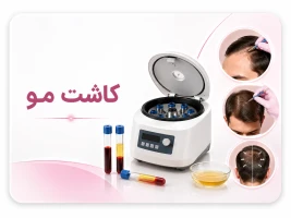 کاربرد سانتریفیوژ PRP در کاشت مو